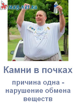 Камни в почках причины образования